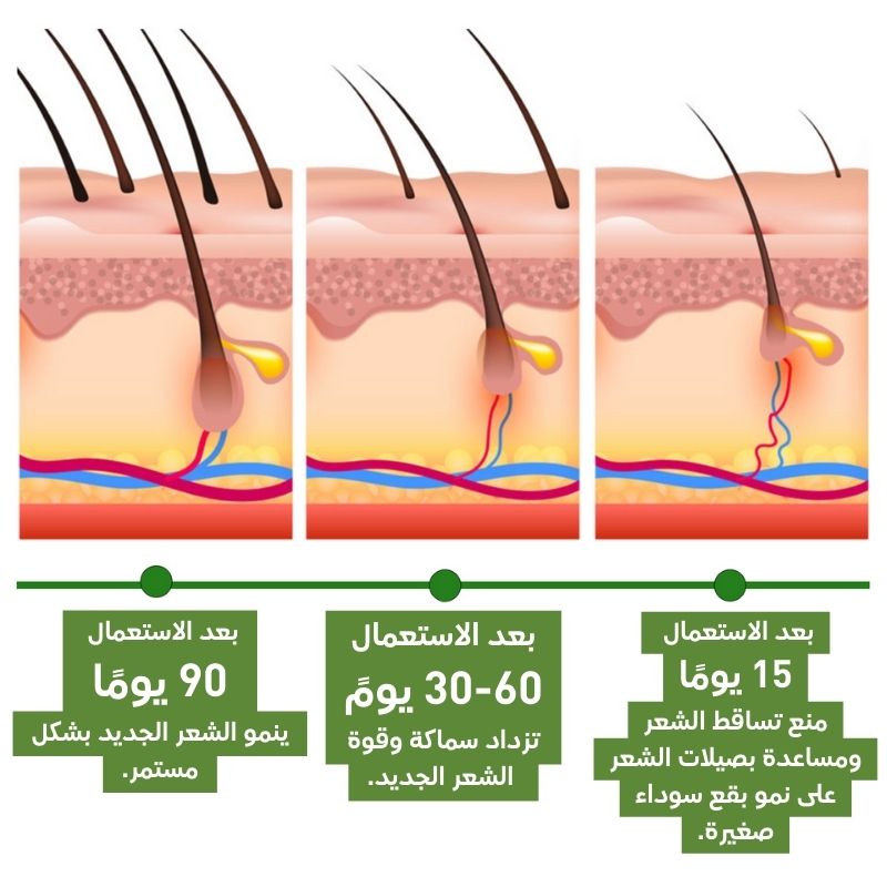 زيت اكليل الجبل لعلاج كل مشاكل الشعر (2)