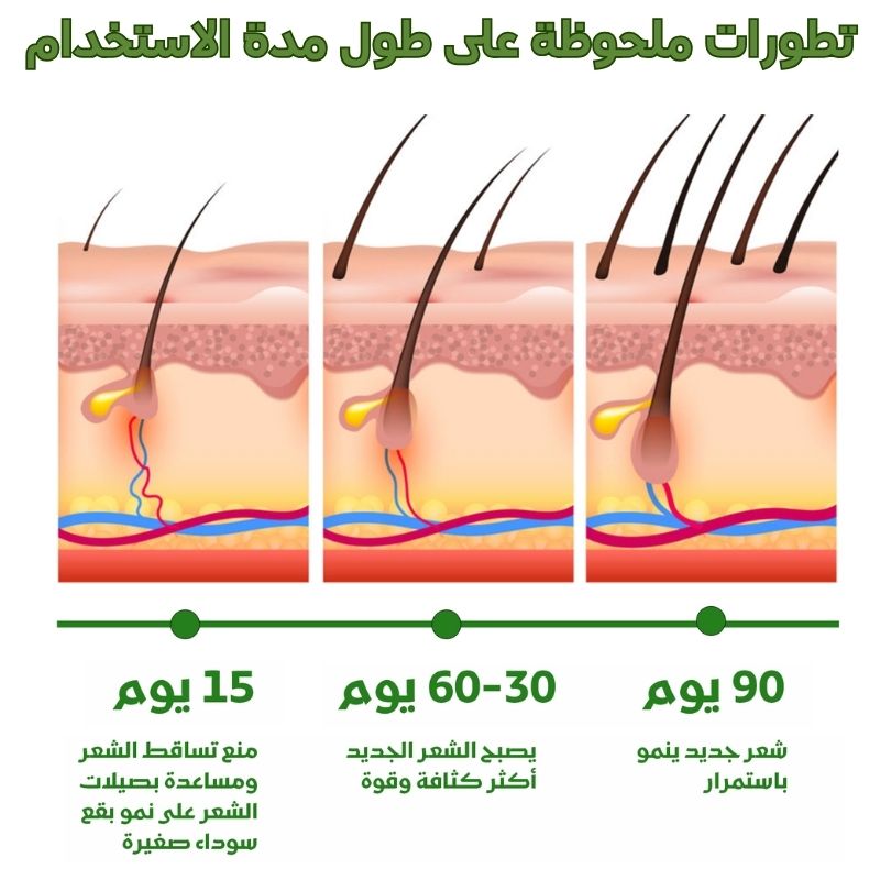 زيت اكليل الجبل لعلاج كل مشاكل الشعر (3)