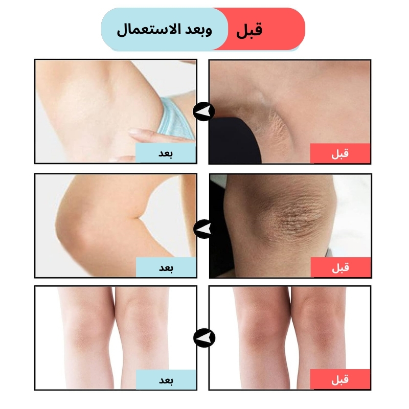 كريم تبييض المناطق الحساسة طبيعي وفعال 60ml